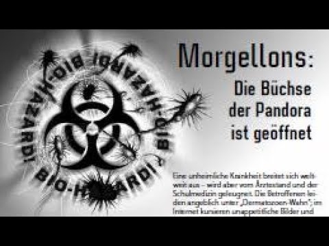 Chemtrails, smart dust (chytrý prach), grafen, těžké kovy a další jedovaté a velmi toxické látky v ovzduší, odhalení další „konspirace“…