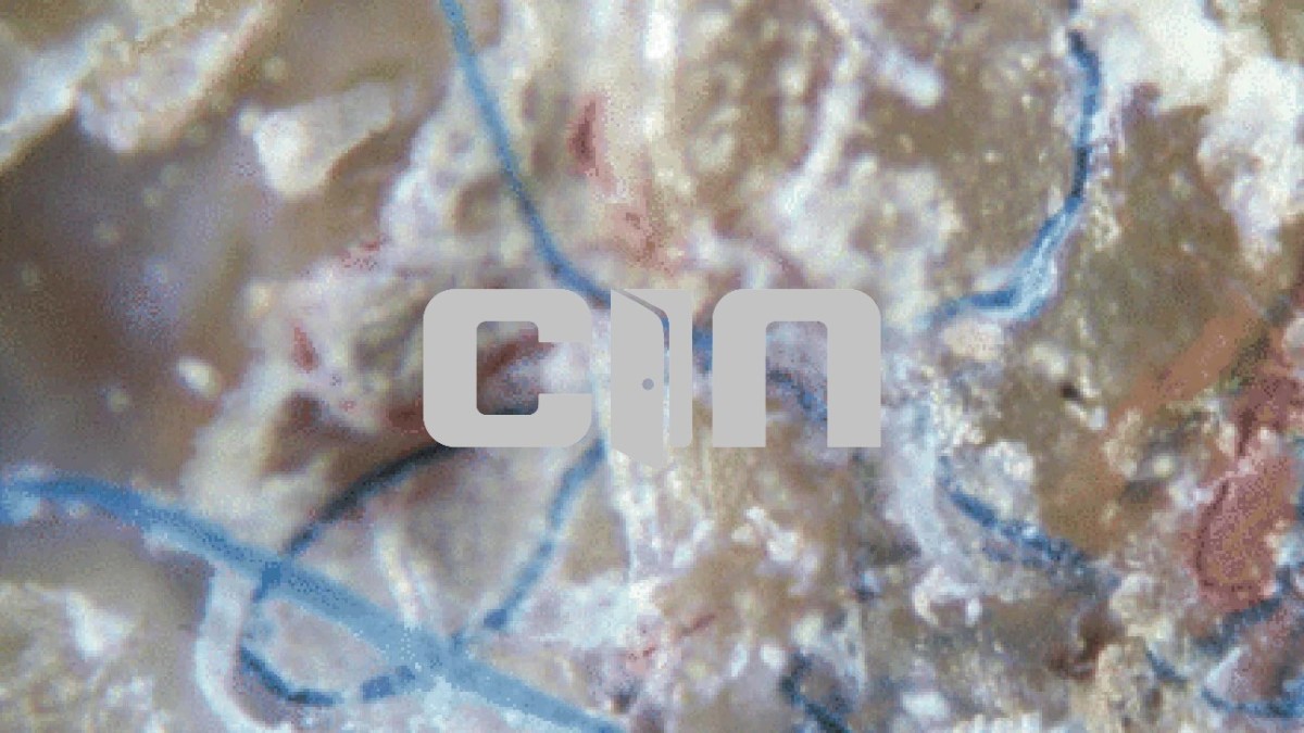 Morgellony: Biologická zbraň nebo záhadná&nbsp;nemoc?